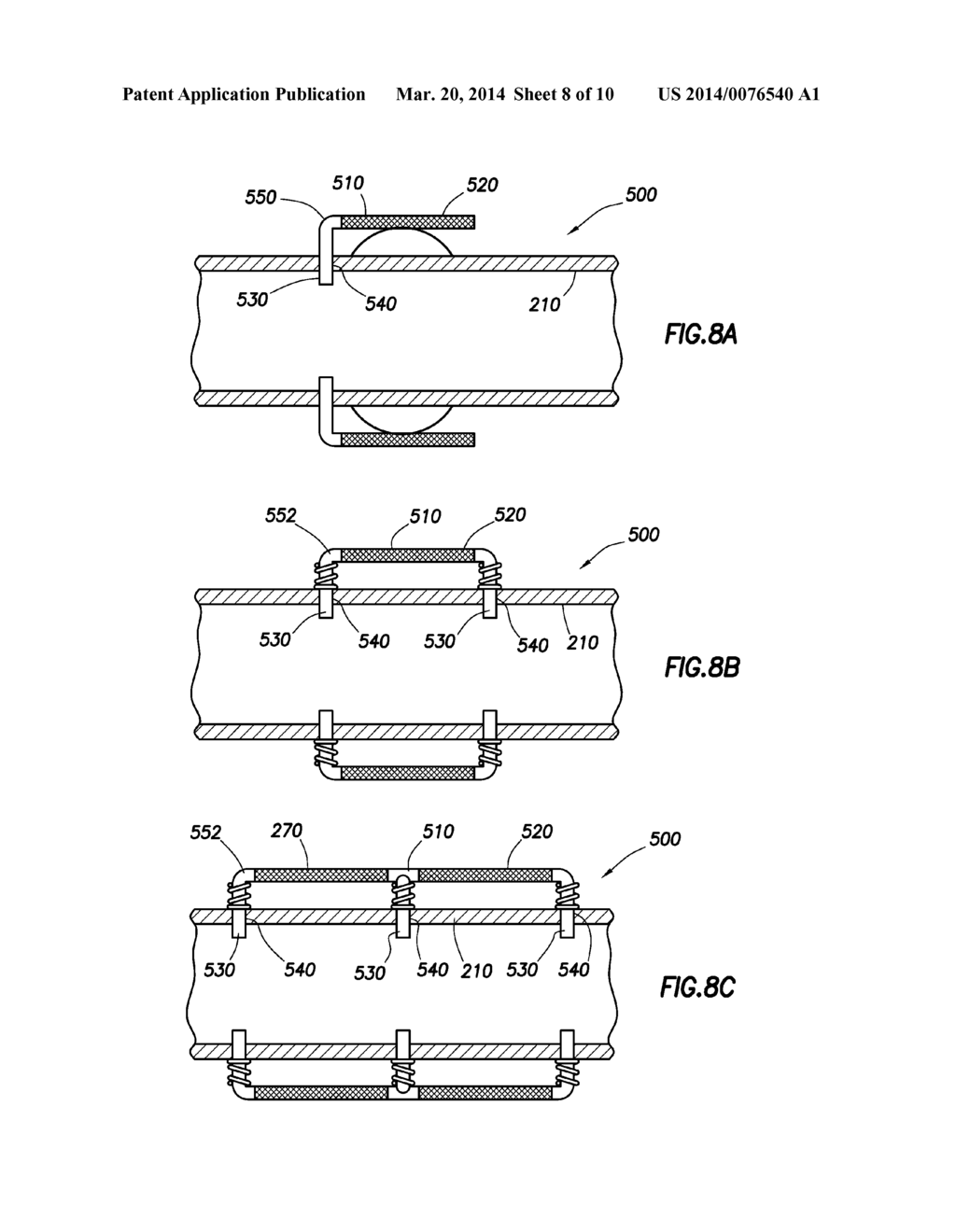 Expandable Screen by Spring Force - diagram, schematic, and image 09