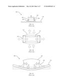 ACOUSTICALLY QUIET CAPACITORS diagram and image