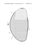 REINFORCED PROSTHETIC IMPLANT WITH FLEXIBLE SHELL diagram and image