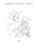 Backrest, Method for Adjusting a Backrest and (Wheel) Chair Provided with     a Backrest diagram and image