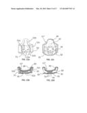 Backrest, Method for Adjusting a Backrest and (Wheel) Chair Provided with     a Backrest diagram and image