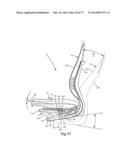 Chair Assembly with Upholstery Covering diagram and image