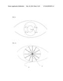 Automatic Refracto-Keratometer diagram and image