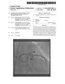 Method and System for Real Time Stent Enhancement on Live 2D Fluoroscopic     Scene diagram and image