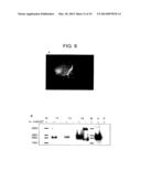 Method for Activating Natural Killer Cells by Tumor Cell Preparation In     Vitro diagram and image