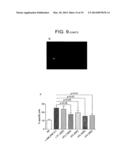 Method for Activating Natural Killer Cells by Tumor Cell Preparation In     Vitro diagram and image