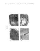 COMBINATIONS AND MODES OF ADMINISTRATION OF THERAPEUTIC AGENTS AND     COMBINATION THERAPY diagram and image