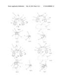 FUNCTIONAL DENTOFACIAL ORTHOPEDIC APPARATUS diagram and image