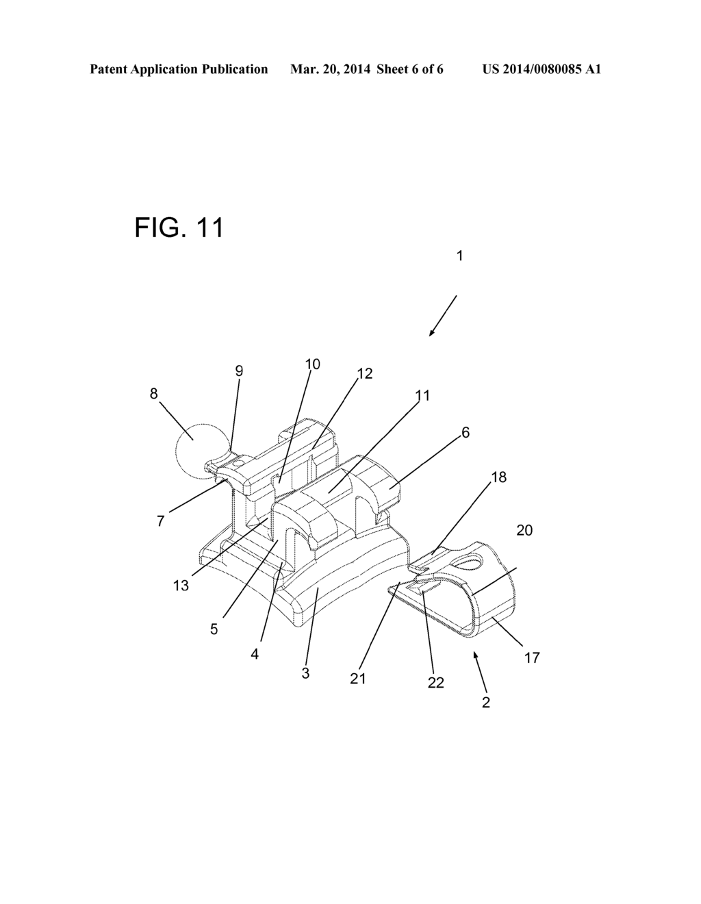 ARRANGEMENT INTRODUCED IN BRACKET WITH CURVILINEAR RIDGES - diagram, schematic, and image 07