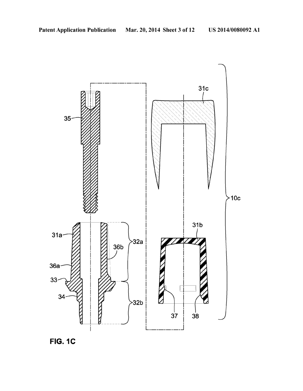 TEMPORARY DENTAL PROSTHESIS FOR USE IN DEVELOPING FINAL DENTAL PROSTHESIS - diagram, schematic, and image 04