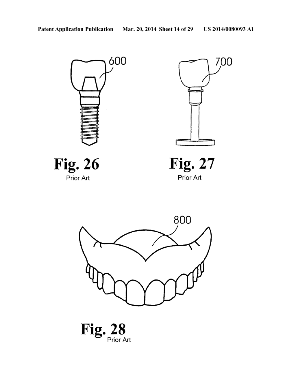 Customized Dental Prosthesis For Periodontal or Osseointegration, and     Related System and Methods - diagram, schematic, and image 15