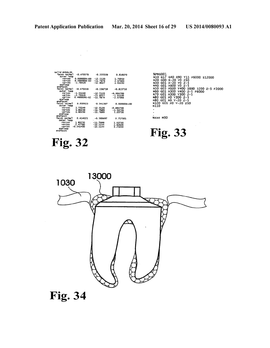 Customized Dental Prosthesis For Periodontal or Osseointegration, and     Related System and Methods - diagram, schematic, and image 17