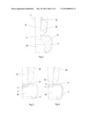 ELECTRICAL COMPONENT FOR A HIGH-VOLTAGE INSTALLATION diagram and image