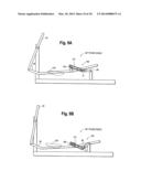 Stride adjustment mechanism diagram and image