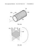 Radiation Detector and Radiotherapy Apparatus diagram and image