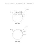 ACCESS DEVICES AND RELATED METHODS OF USE diagram and image