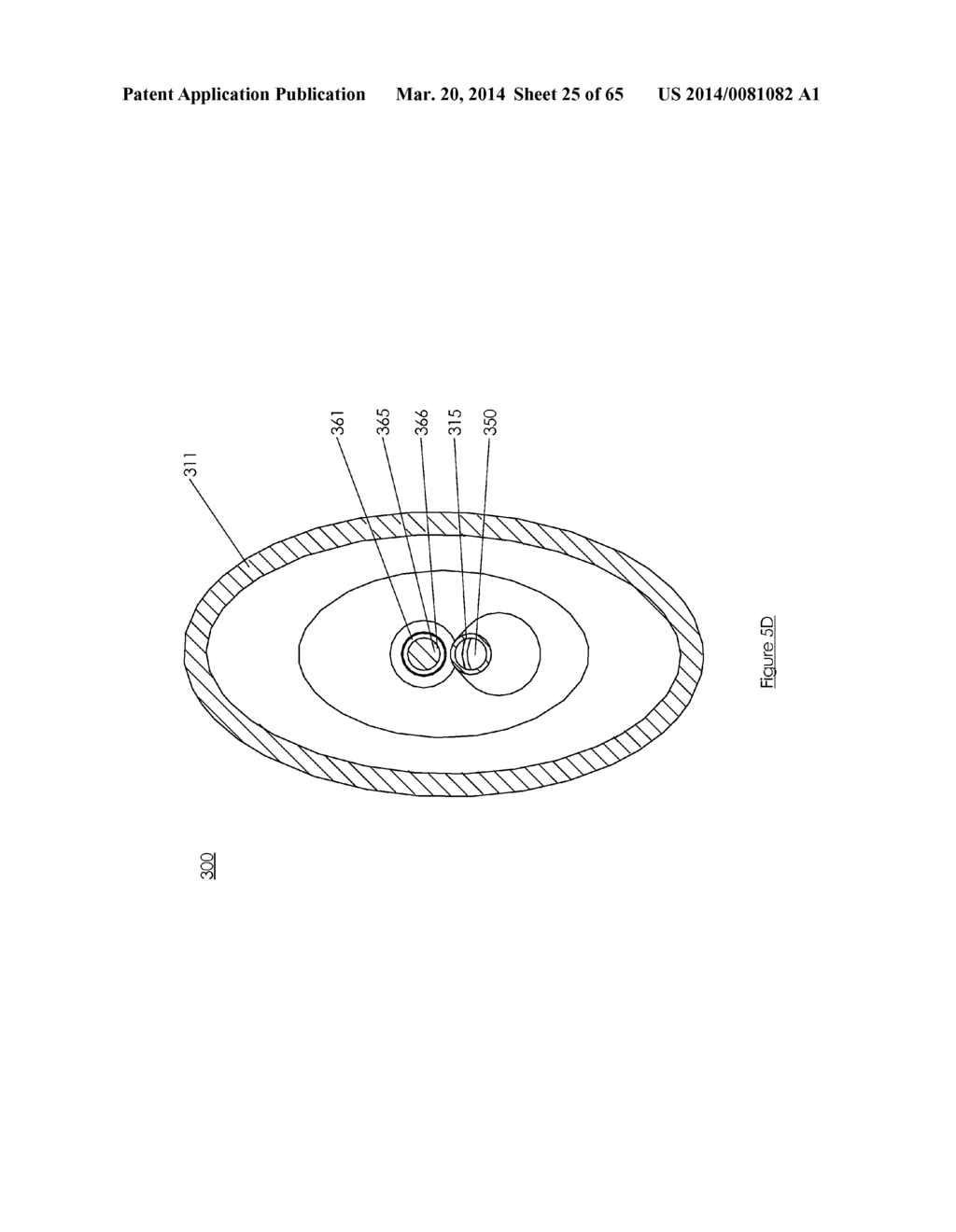 Methods and devices for visualization and access - diagram, schematic, and image 26