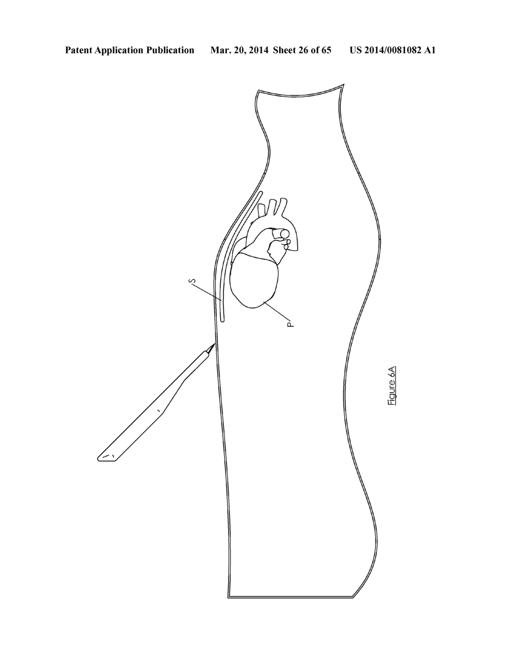 Methods and devices for visualization and access - diagram, schematic, and image 27