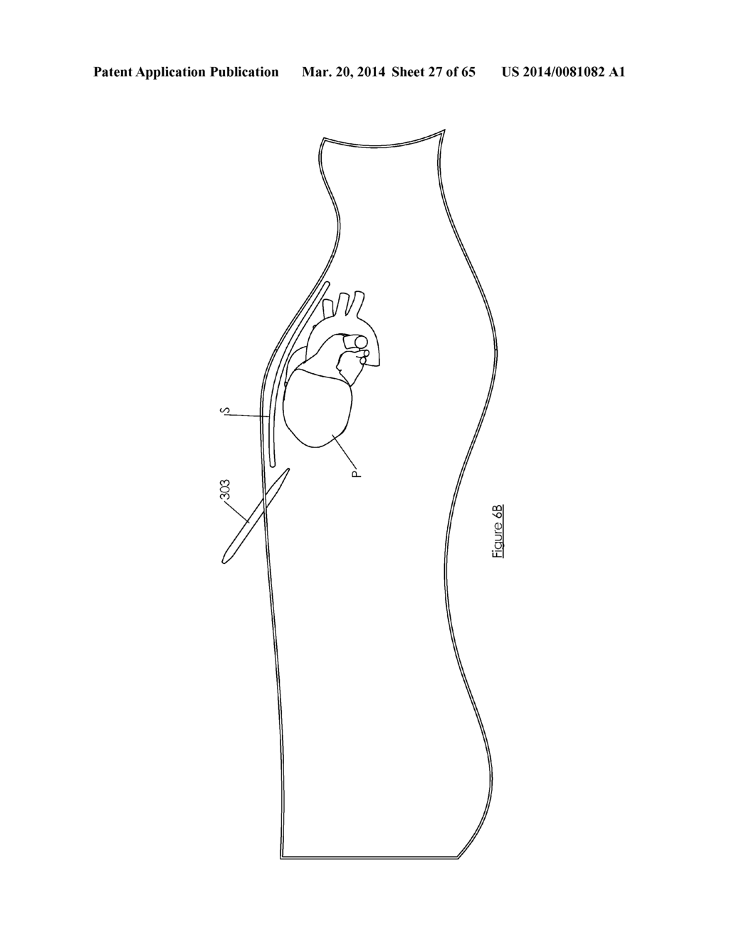 Methods and devices for visualization and access - diagram, schematic, and image 28