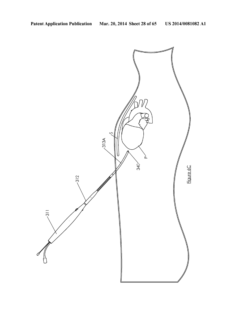 Methods and devices for visualization and access - diagram, schematic, and image 29