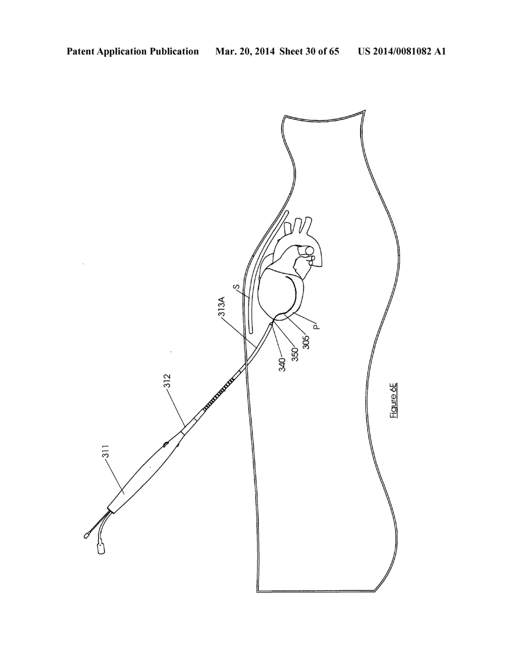 Methods and devices for visualization and access - diagram, schematic, and image 31