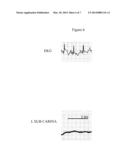 ELECTROPHYSIOLOGICAL DIAGNOSIS AND TREATMENT FOR ASTHMA diagram and image