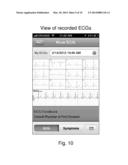ELECTROCARDIOGRAPHIC MONITORING SYSTEM AND METHOD diagram and image