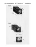 ANGIOGRAPHIC EXAMINATION METHOD diagram and image