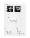 ANGIOGRAPHIC EXAMINATION METHOD diagram and image