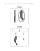 ULTRASONIC DIAGNOSTIC APPARATUS AND IMAGE PROCESSING APPARATUS diagram and image