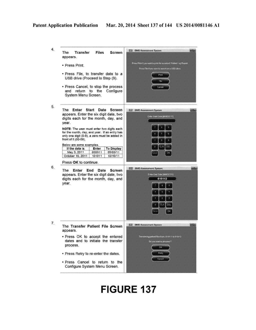 BONE MINERAL DENSITY MEASUREMENT APPARATUS AND METHOD - diagram, schematic, and image 138