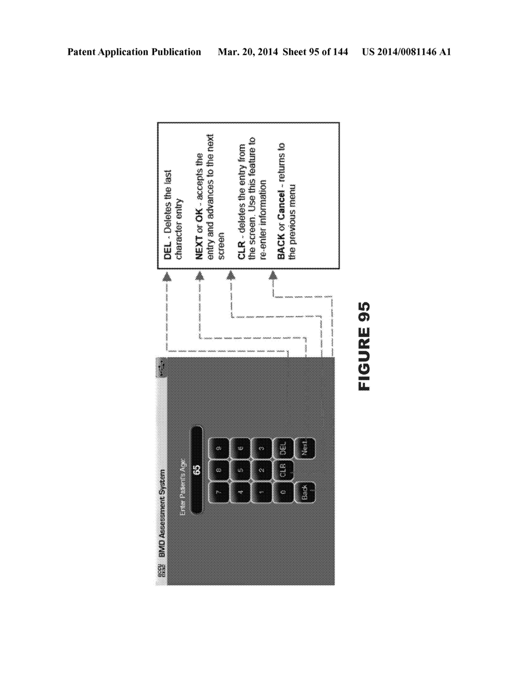 BONE MINERAL DENSITY MEASUREMENT APPARATUS AND METHOD - diagram, schematic, and image 96