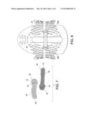 PANEL ATTACHMENT AND CIRCUMFERENCE ADJUSTMENT SYSTEMS FOR AN ORTHOPEDIC     DEVICE diagram and image