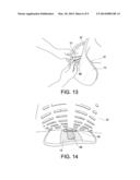 PANEL ATTACHMENT AND CIRCUMFERENCE ADJUSTMENT SYSTEMS FOR AN ORTHOPEDIC     DEVICE diagram and image