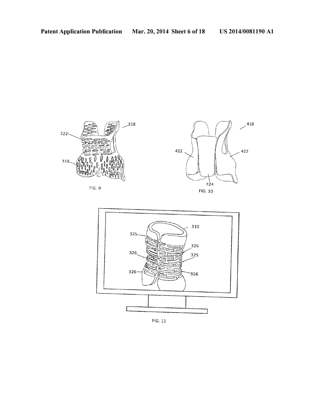 FLEXIBLE BRACES, CASTS AND DEVICES AND METHODS FOR DESIGNING AND     FABRICATING - diagram, schematic, and image 07