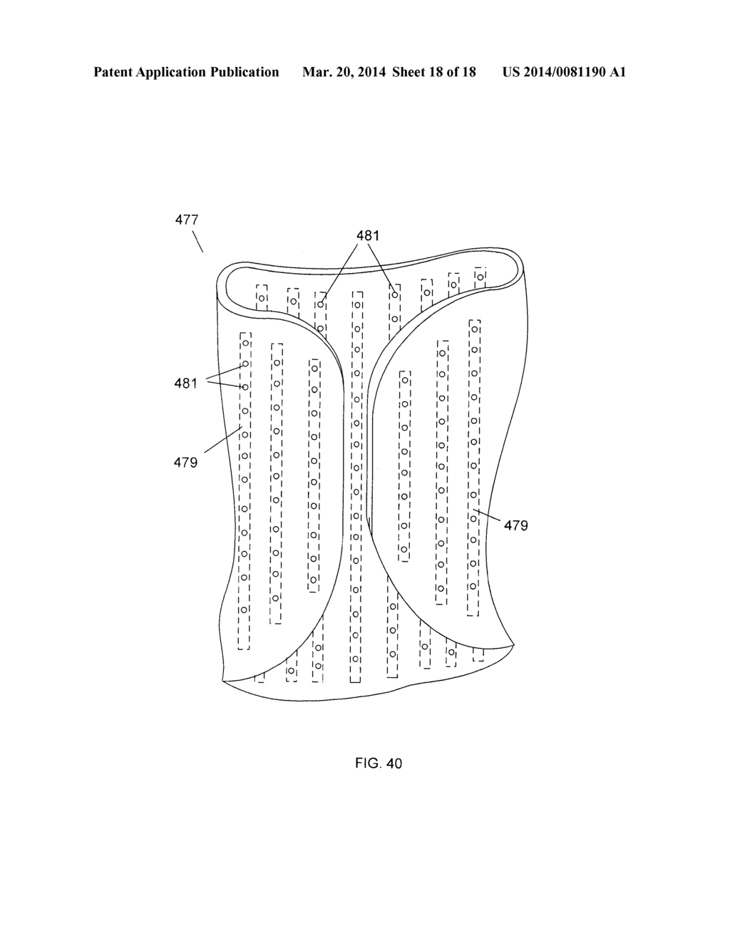 FLEXIBLE BRACES, CASTS AND DEVICES AND METHODS FOR DESIGNING AND     FABRICATING - diagram, schematic, and image 19