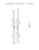 PRESSURE SENSING GUIDEWIRE diagram and image