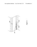 PRESSURE SENSING GUIDEWIRE diagram and image