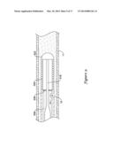 PRESSURE SENSING GUIDEWIRE diagram and image