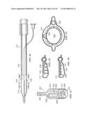 SYSTEM FOR PERCUTANEOUSLY ADMINISTERING REDUCED PRESSURE TREATMENT USING     BALLOON DISSECTION diagram and image