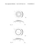 METHOD FOR EYE SURGERY diagram and image