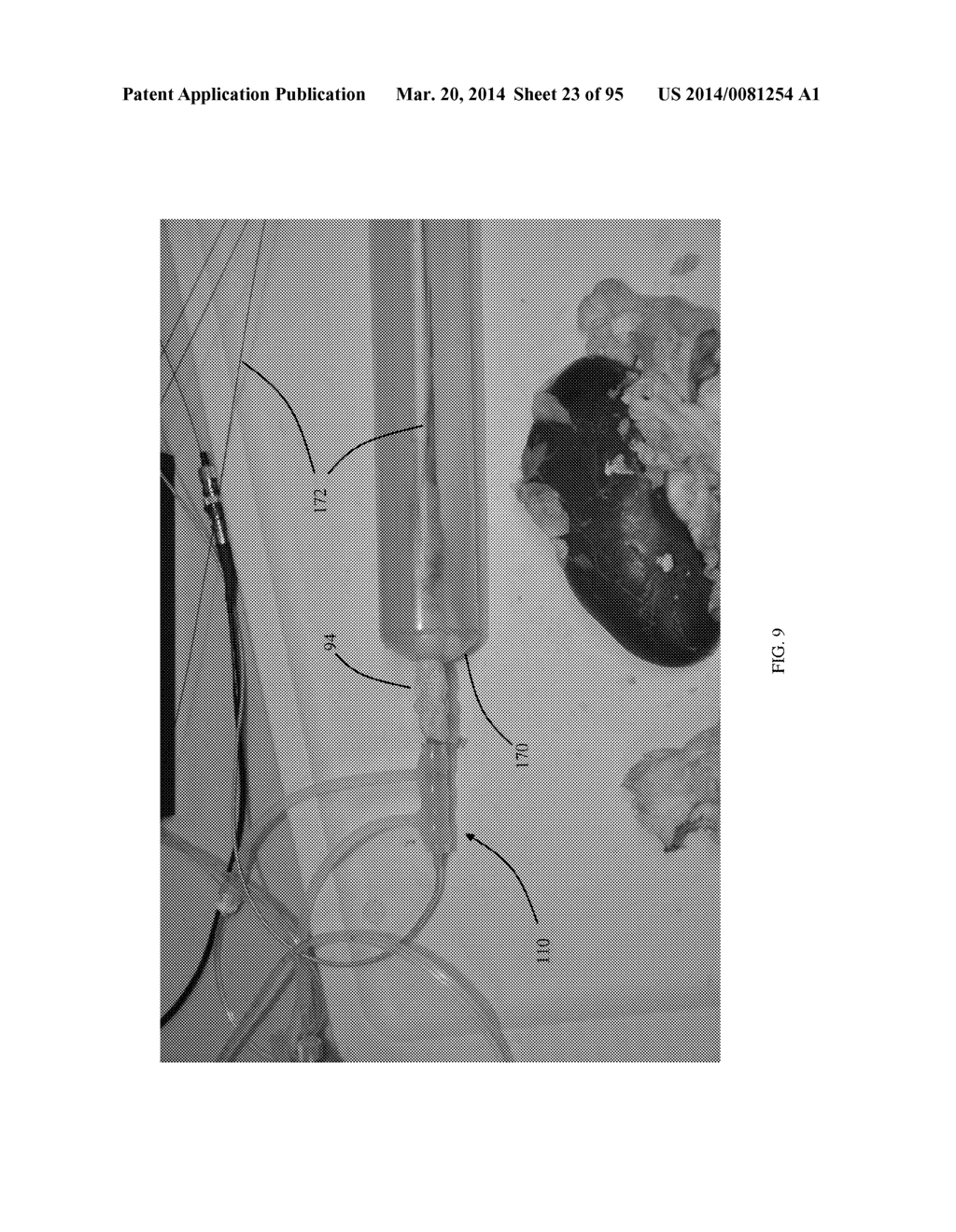 COOLED MICROWAVE DENERVATION - diagram, schematic, and image 24