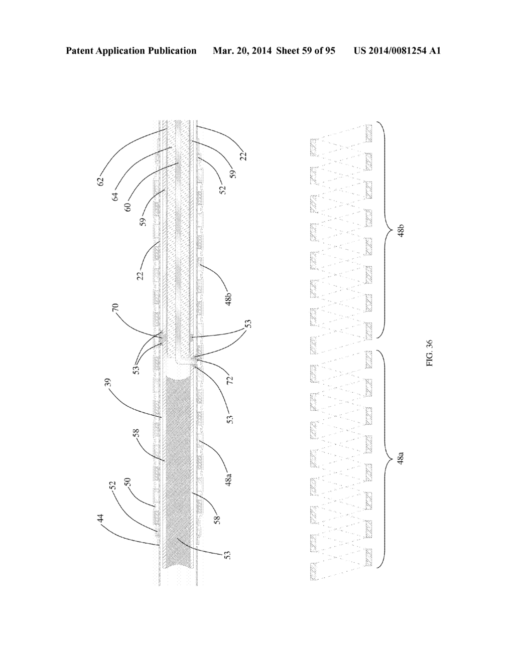 COOLED MICROWAVE DENERVATION - diagram, schematic, and image 60