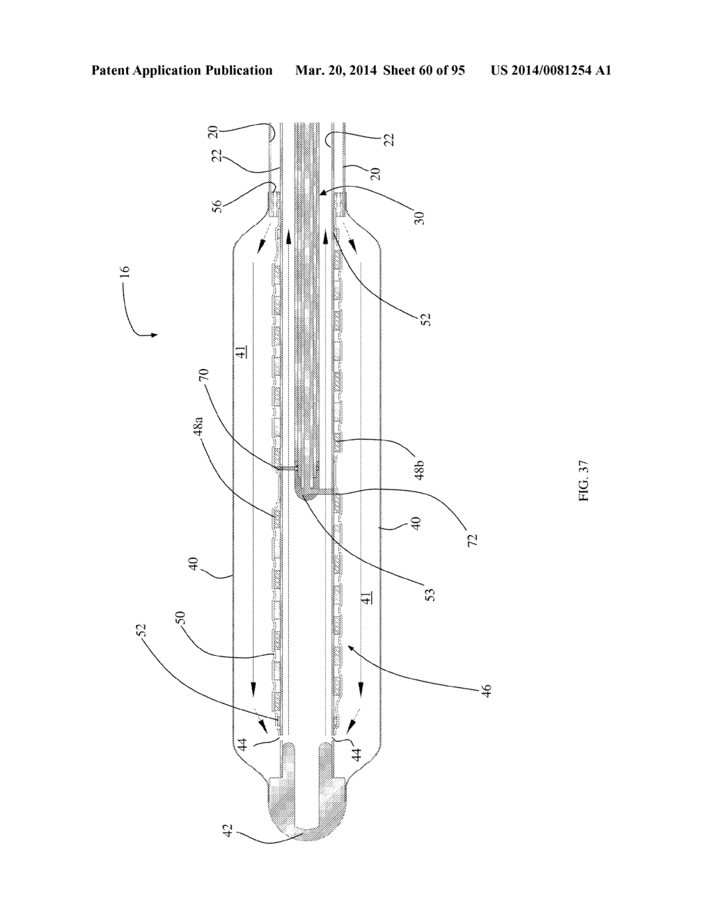 COOLED MICROWAVE DENERVATION - diagram, schematic, and image 61