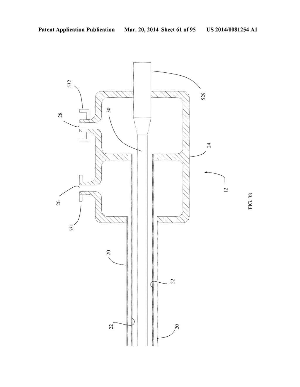 COOLED MICROWAVE DENERVATION - diagram, schematic, and image 62