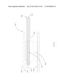 COOLED MICROWAVE DENERVATION diagram and image