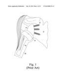 BONE GRAFT SHAPER FOR REVERSE GLENOID diagram and image