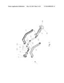 SURGICAL INSTRUMENT FOR ACETABULAR CUP IMPLANTATION diagram and image