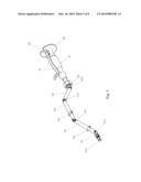 SURGICAL INSTRUMENT FOR ACETABULAR CUP IMPLANTATION diagram and image