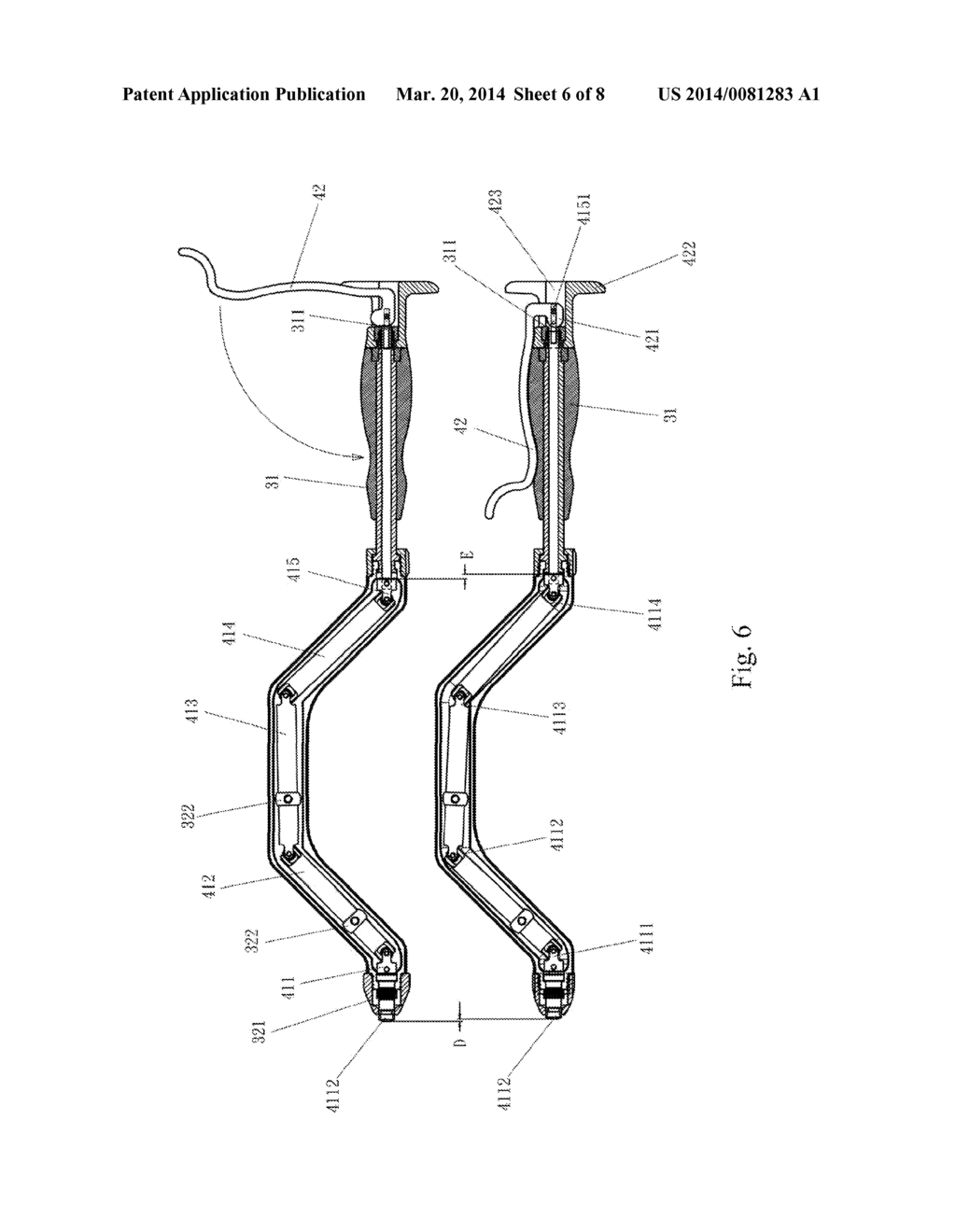 SURGICAL INSTRUMENT FOR ACETABULAR CUP IMPLANTATION - diagram, schematic, and image 07